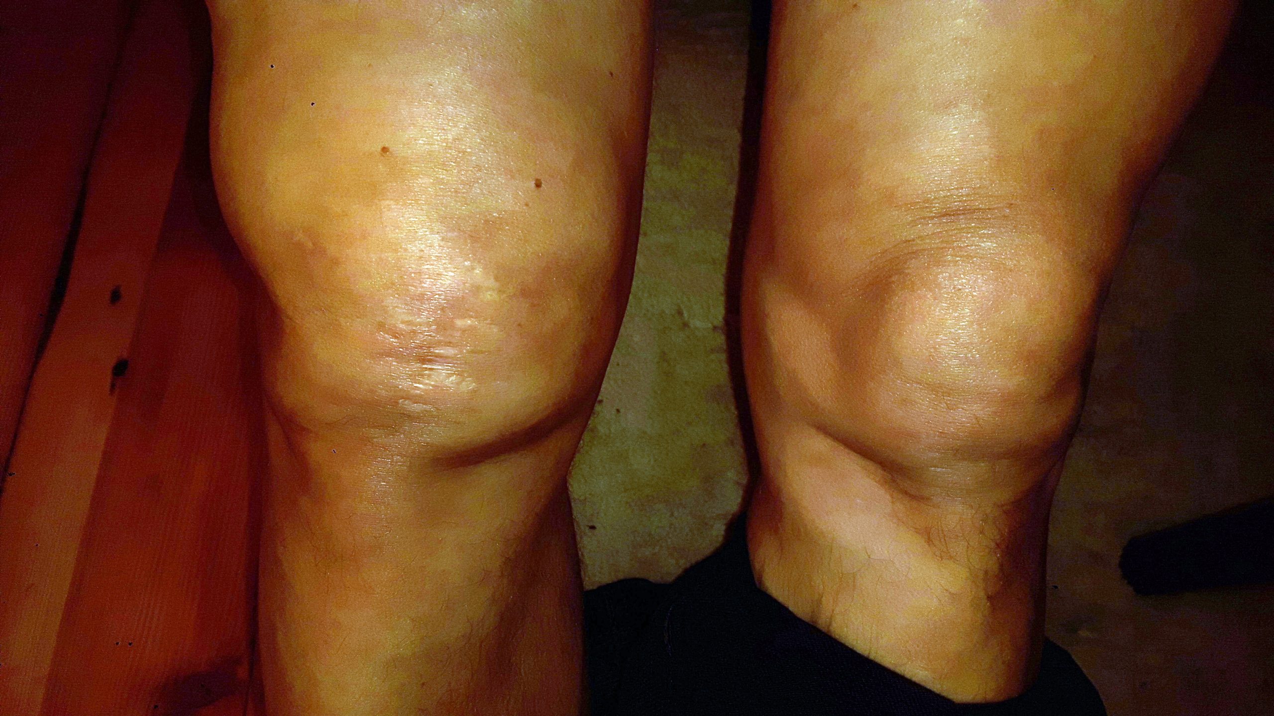 Konrad Knie operiert